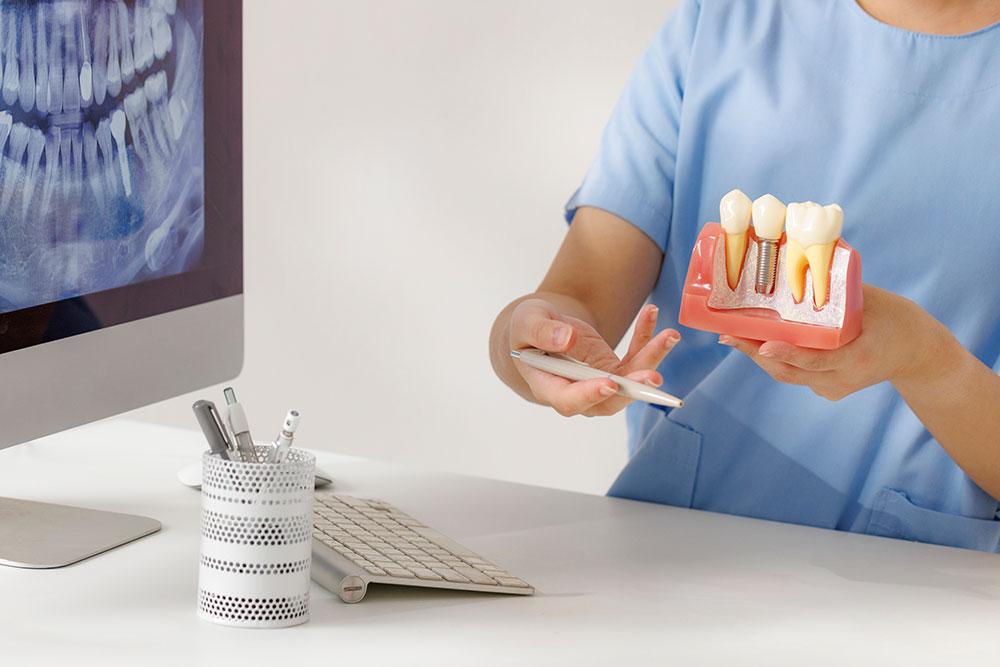 성공적인 임플란트 식립, 더끌림치과의원 