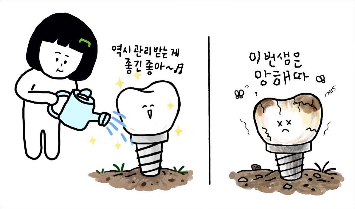 임플란트 치료도 중요하지만 치료 후 관리가 더욱 중요합니다. 임플란트 관리하는 모