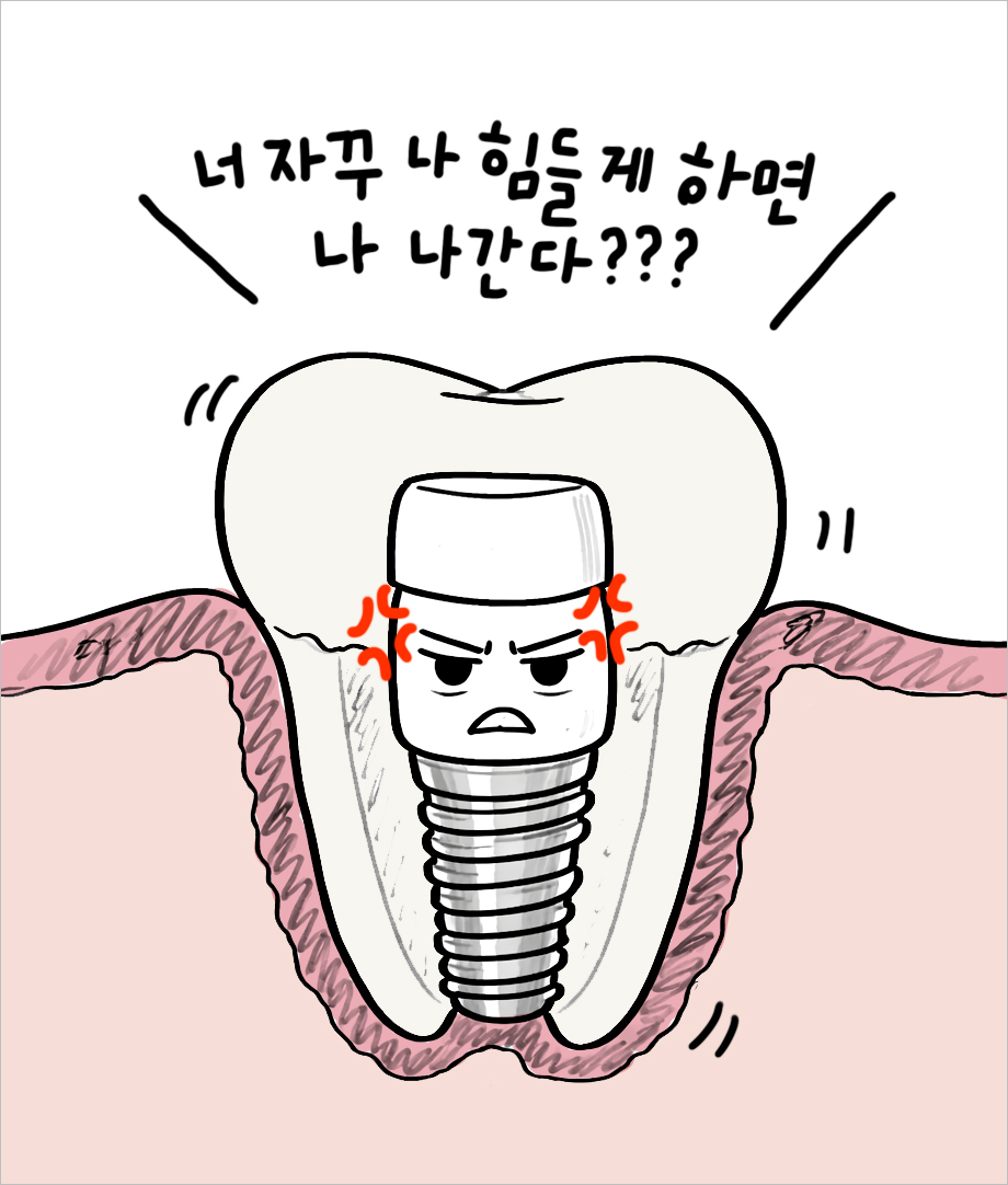 임플란트의 수명은 관리가 좌우합니다. 관리를 제대로 못하면 도망가겠다는 임플란트를 의인화한 모습